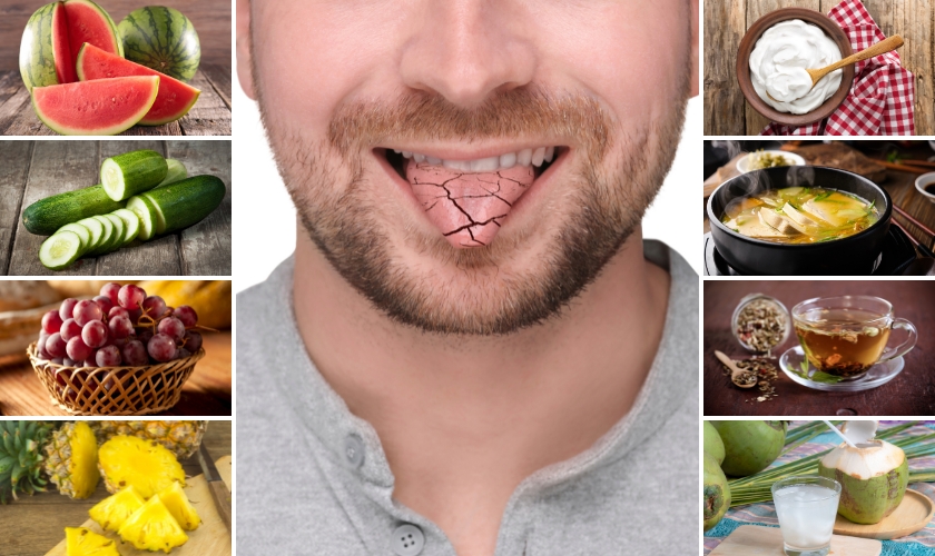 best foods to eat when you have dry mouth