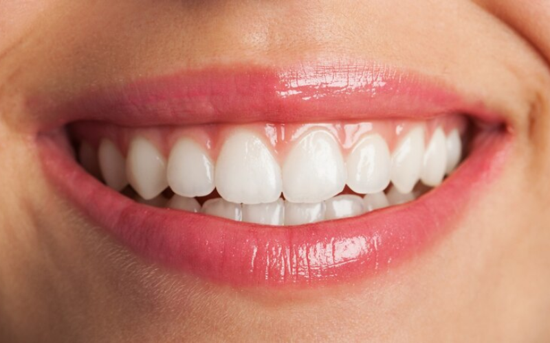 Top Cosmetic Dentistry To Consider