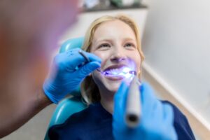 tips on teeth whitening for valentine's day